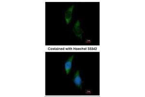 ICC/IF Image Immunofluorescence analysis of methanol-fixed HeLa, using FARSLA, antibody at 1:200 dilution. (Phenylalanyl-tRNA Synthetase, alpha Subunit (FARSA) antibody)