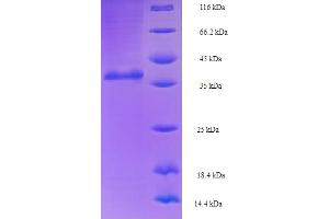 SDS-PAGE (SDS) image for RAN, Member RAS Oncogene Family (RAN) (AA 2-219) protein (His-SUMO Tag) (ABIN5710886) (RAN Protein (AA 2-219) (His-SUMO Tag))