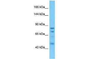 Host:  Rabbit  Target Name:  CGN  Sample Type:  Uterus Tumor lysates  Antibody Dilution:  1. (Cingulin antibody  (N-Term))