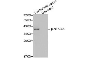 Western Blotting (WB) image for anti-Nuclear Factor of kappa Light Polypeptide Gene Enhancer in B-Cells Inhibitor, alpha (NFKBIA) (pTyr42) antibody (ABIN1870480) (NFKBIA antibody  (pTyr42))