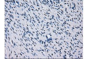 Immunohistochemical staining of paraffin-embedded colon tissue using anti-RNF144Bmouse monoclonal antibody.