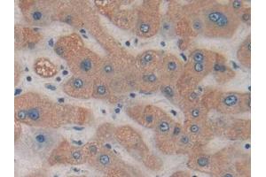 DAB staining on IHC-P; Samples: Human Liver Tissue (HDC antibody  (AA 160-369))