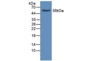 Detection of LIPC in Human Liver Tissue using Polyclonal Antibody to Lipase, Hepatic (LIPC) (LIPC antibody  (AA 25-247))