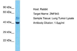 Host: Rabbit Target Name: ZNF843 Sample Type: Lung Tumor lysates Antibody Dilution: 1. (ZNF843 antibody  (N-Term))