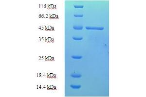 SDS-PAGE (SDS) image for Paraneoplastic Antigen MA2 (PNMA2) (AA 2-263), (partial) protein (His tag) (ABIN5710121) (PNMA2 Protein (AA 2-263, partial) (His tag))