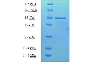 SDS-PAGE (SDS) image for Paraneoplastic Antigen MA2 (PNMA2) (AA 2-263), (partial) protein (His tag) (ABIN5710121) (PNMA2 Protein (AA 2-263, partial) (His tag))