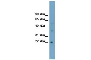 WB Suggested Anti-LDLRAD1 Antibody Titration:  0. (LDLRAD1 antibody  (Middle Region))