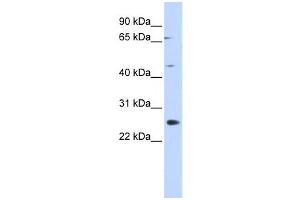 Western Blotting (WB) image for anti-Spermatogenesis Associated 22 (SPATA22) antibody (ABIN2460089) (SPATA22 antibody)