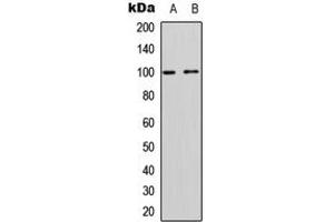 Western blot analysis of CD167a expression in Jurkat (A), rat muscle (B) whole cell lysates.