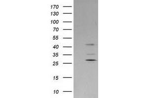 HEK293T cells were transfected with the pCMV6-ENTRY control (Left lane) or pCMV6-ENTRY SERPINB2 (Right lane) cDNA for 48 hrs and lysed. (SERPINB2 antibody)