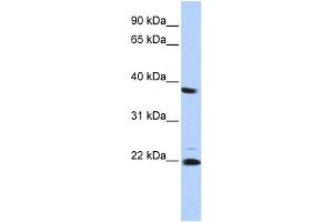 WB Suggested Anti-PSMB2 Antibody Titration: 0. (PSMB2 antibody  (Middle Region))