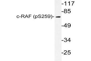 Western blot (WB) analysis of p-c-RAF (pSer259) pAb in extracts from K562 cells. (RAF1 antibody  (pSer259))