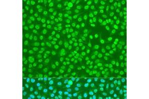 Immunofluorescence analysis of U2OS cells using HNRNPDL Polyclonal Antibody at dilution of 1:100. (HNRPDL antibody)