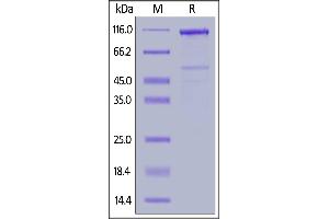 LRP6 Protein (AA 20-630) (Fc Tag)
