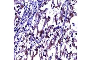 Immunohistochemistry (IHC) image for anti-Tumor Necrosis Factor Receptor Superfamily, Member 11b (TNFRSF11B) (AA 243-271) antibody (ABIN3029353)