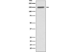 Western blot analysis of ASPP2 expression in MCF7 cell lysate.