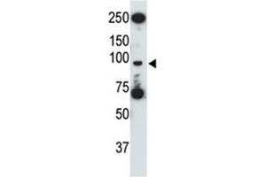 TLR5 antibody used in western blot to detect TLR5 in HL-60 cell lysate (TLR5 antibody  (AA 825-856))