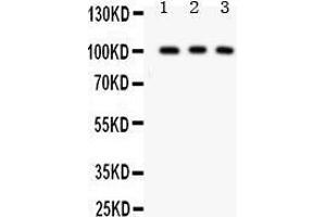 Anti- CD146 antibody, Western blotting All lanes: Anti CD146  at 0.