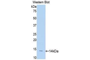 Western blot analysis of the recombinant protein. (SLIT1 antibody  (AA 3-112))