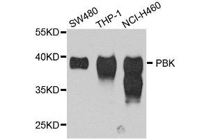 Western blot analysis of extract of various cells, using SPK antibody. (Symplekin antibody)