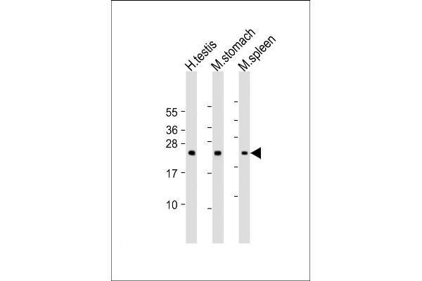 NAA40 antibody  (AA 179-222)