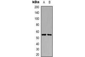 Western blot analysis of PKE expression in A431 (A), Raji (B) whole cell lysates. (STK32C antibody)