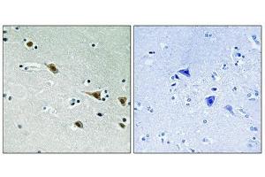 Immunohistochemical analysis of paraffin-embedded humanbrain tissue, using MAP2K7 (Phospho-Ser271) antibody (left)or the same antibody preincubated with blocking peptide (right). (MAP2K7 antibody  (pSer271))