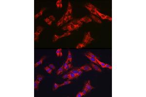 Immunofluorescence analysis of C6 cells using G6PC3 Rabbit pAb (ABIN7267401) at dilution of 1:200 (40x lens). (G6PC3 antibody  (AA 50-150))