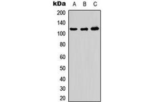 Western blot analysis of ADAMTS10 expression in HeLa (A), PC12 (B), Raw264. (ADAMTS10 antibody  (Center))