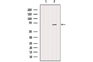 Western blot analysis of extracts from Mouse muscle, using PRPF38B Antibody.