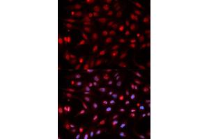 Immunofluorescence analysis of HeLa cells using APEX1 antibody. (APEX1 antibody  (AA 1-318))