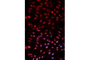 Immunofluorescence analysis of HeLa cells using APEX1 antibody. (APEX1 antibody  (AA 1-318))