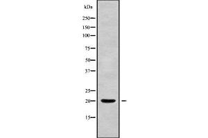 Calcineurin B antibody  (N-Term)