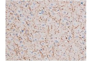 ABIN6256264 and ABIN6267484 at 1/200 staining Rat brain tissue sections by IHC-P.