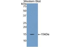 Western Blotting (WB) image for anti-Drosha, Ribonuclease Type III (DROSHA) (AA 1114-1235) antibody (ABIN7435376)