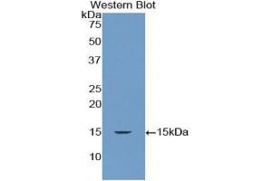 Detection of Recombinant RNASEN, Human using Polyclonal Antibody to Ribonuclease III, Nuclear (RNASEN) (DROSHA antibody  (AA 1114-1235))