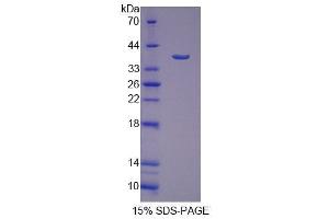 SDS-PAGE (SDS) image for Signal Sequence Receptor, alpha (SSR1) (AA 19-286) protein (His tag) (ABIN6239211)