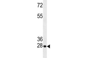 Anti-Bcl-2 antibody western blot analysis in HeLa lysate (Bcl-2 antibody  (AA 49-76))