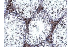 IHC-P Image TrxR1 antibody [N1N3] detects TrxR1 protein at cytoplasm on mouse testis by immunohistochemical analysis. (TXNRD1 antibody)