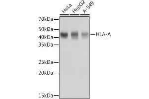 Western blot analysis of extracts of various cell lines, using HLA-A antibody (ABIN7268366) at 1:1000 dilution. (HLA-A antibody)