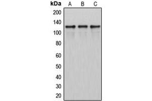 Western blot analysis of ITPKB expression in HeLa (A), SP2/0 (B), H9C2 (C) whole cell lysates. (ITPKB antibody  (Center))