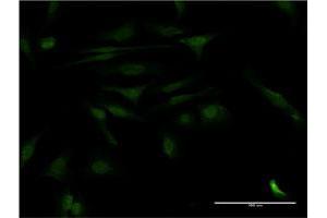 Immunofluorescence of monoclonal antibody to CALCOCO2 on HeLa cell. (CALCOCO2 antibody  (AA 347-446))