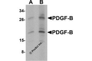 Western Blotting (WB) image for anti-Platelet Derived Growth Factor Subunit B (PDGFB) (C-Term) antibody (ABIN1077433) (PDGFB antibody  (C-Term))