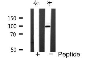 Western blot analysis of GluR4 expression in JK cells (Metabotropic Glutamate Receptor 4 antibody  (C-Term))