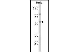 Western blot analysis of SARS2 Antibody in Hela cell line lysates (35ug/lane) (SARS2 antibody  (AA 315-344))