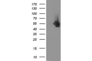 HEK293T cells were transfected with the pCMV6-ENTRY control (Left lane) or pCMV6-ENTRY DOK7 (Right lane) cDNA for 48 hrs and lysed. (DOK7 antibody)