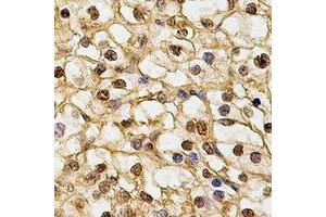 Immunohistochemical analysis of DNAJB6 staining in human kidney formalin fixed paraffin embedded tissue section. (DNAJB6 antibody)