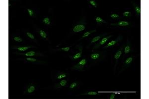 Immunofluorescence of purified MaxPab antibody to ZCCHC9 on HeLa cell. (ZCCHC9 antibody  (AA 1-271))