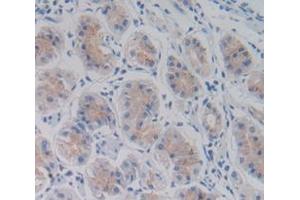 Figure. (PDK4 antibody  (AA 73-316))