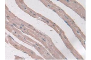 Figure. (Adiponectin Receptor 2 antibody  (AA 1-147))